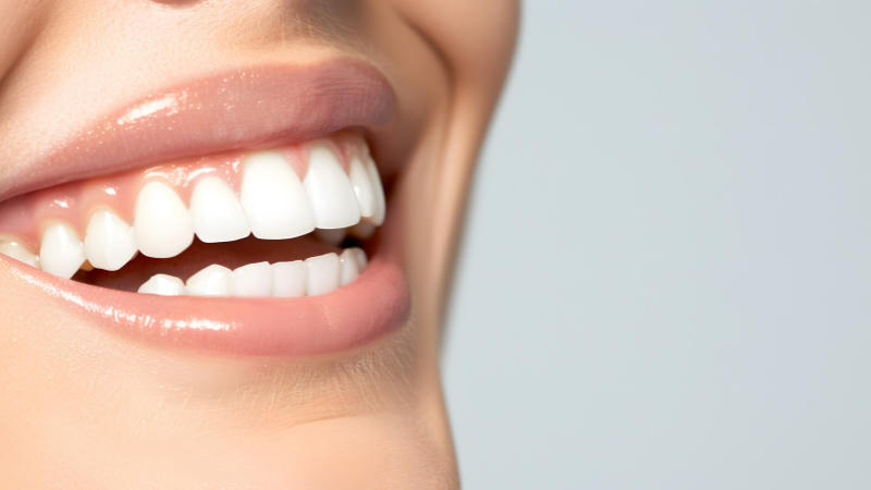 口角が下がる,美人